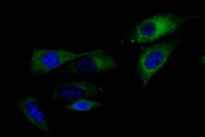 Marcadores Fluorescentes